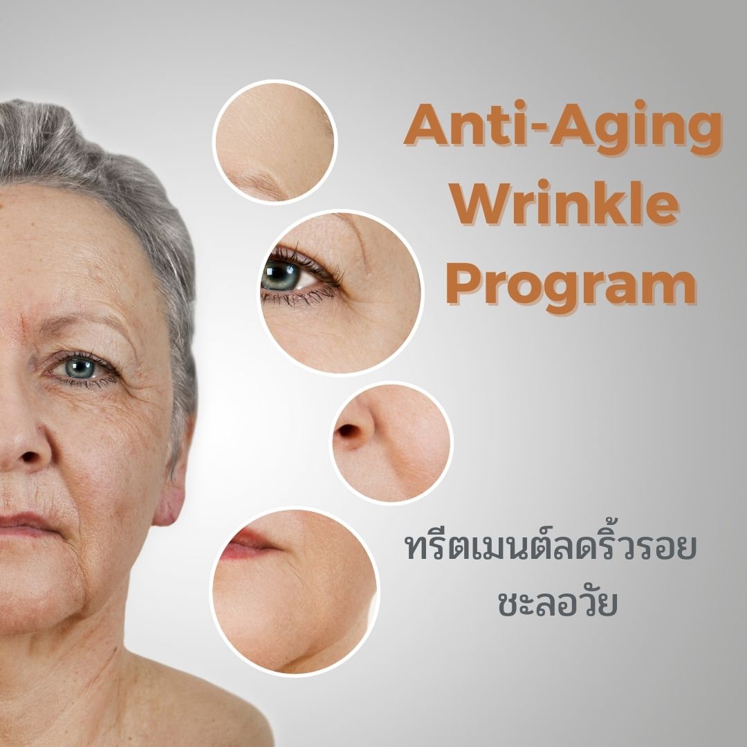ANTIAGING WRINKLE PROGRAM ลดริ้วรอย Phimphika Clinic